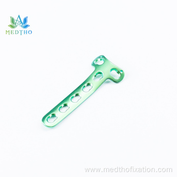 proximal lateral tibia locking plate